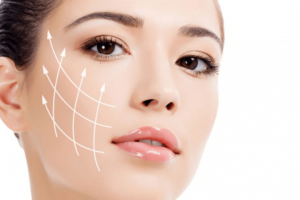 platlet-rich-plasma