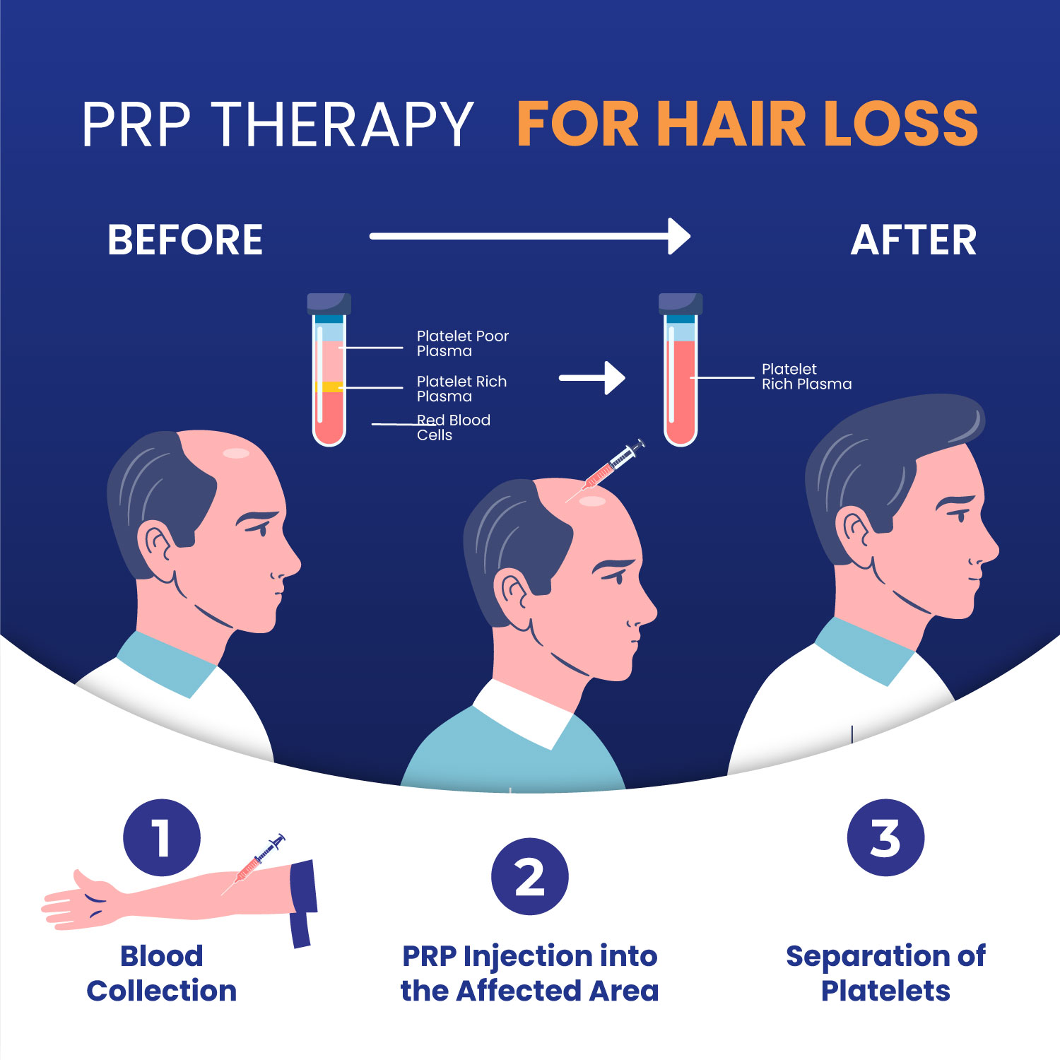 Platelet Rich Plasma (PRP) - MoleChex - Skin Cancer and Melanoma Clinic