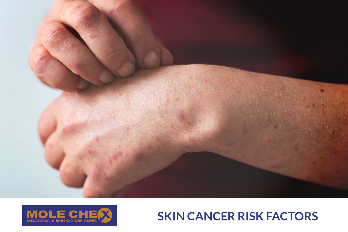 Skin Cancer Risk Factors: Know Your Vulnerabilities