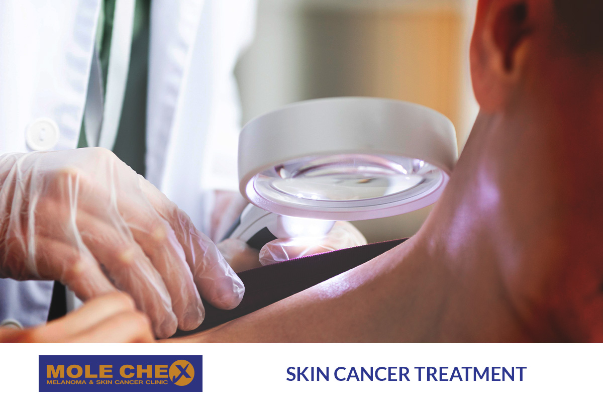 Best Practice Skin Cancer Treatment
