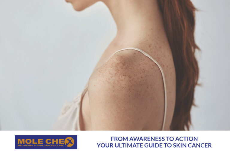 From Awareness to Action: Your Ultimate Guide to Skin Cancer Prevention