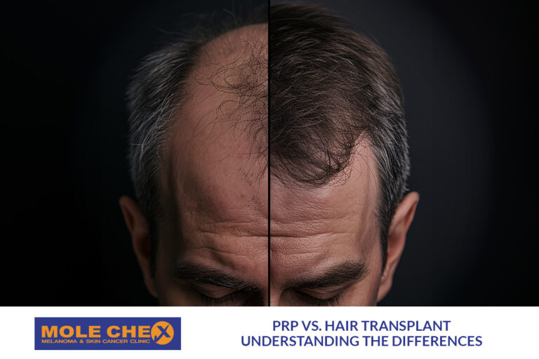 PRP vs. Hair Transplant: Understanding the Differences