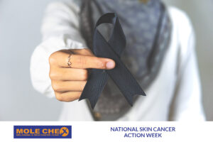 National Skin Cancer Action Week: A Vital Time for Skin Health Awareness