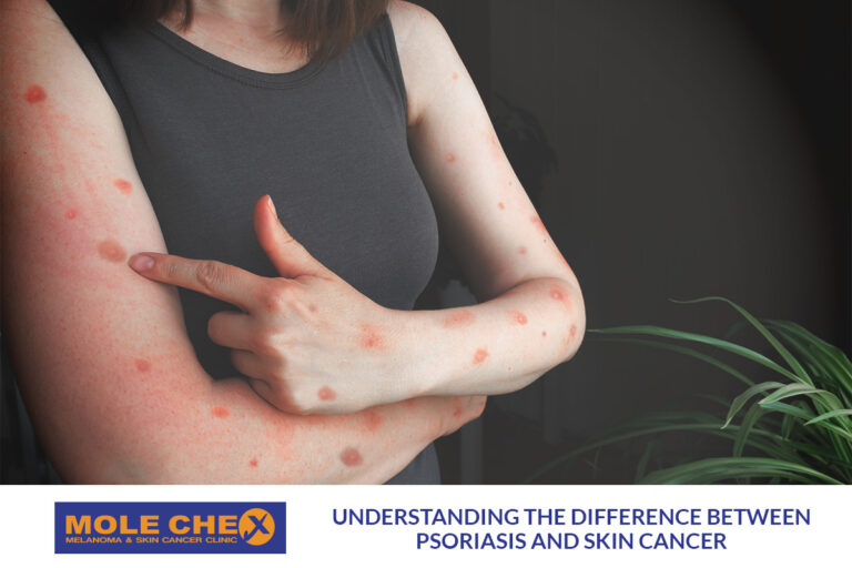 Understanding the Difference Between Psoriasis and Skin Cancer