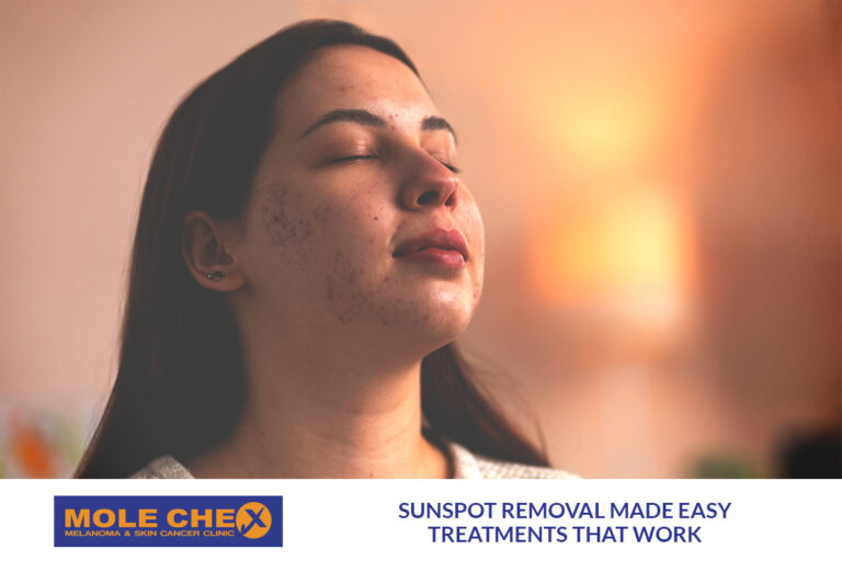 Sunspot Removal Made Easy: Treatments That Work