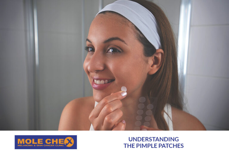 Understanding Pimple Patches: A Simple Solution for Breakouts