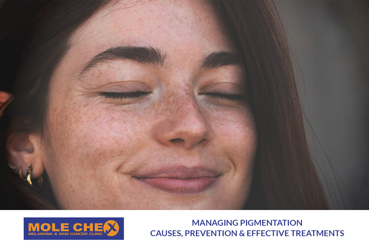 Managing Pigmentation: Causes, Prevention & Treatments