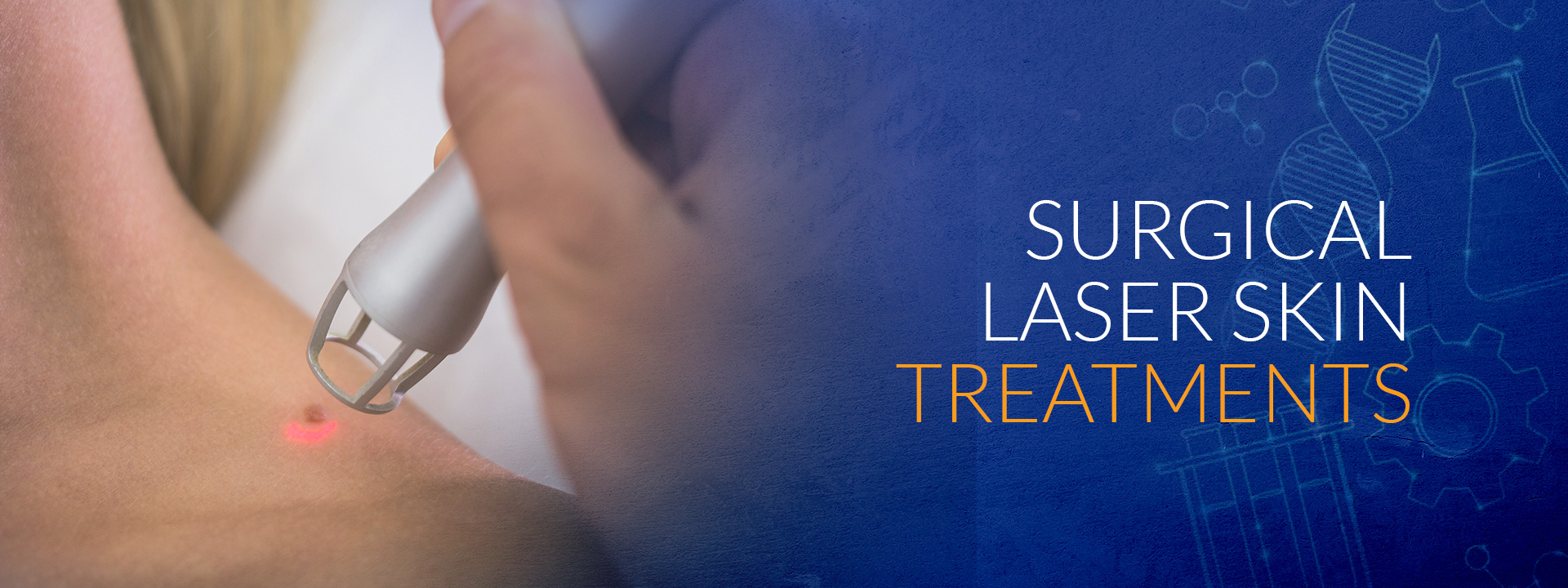 Surgical Laser Treatments