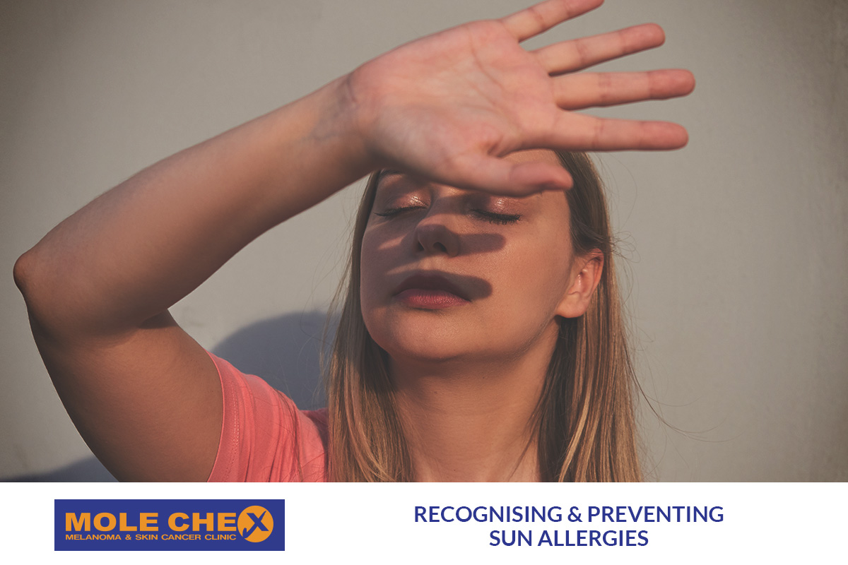Recognising and Preventing Sun Allergies