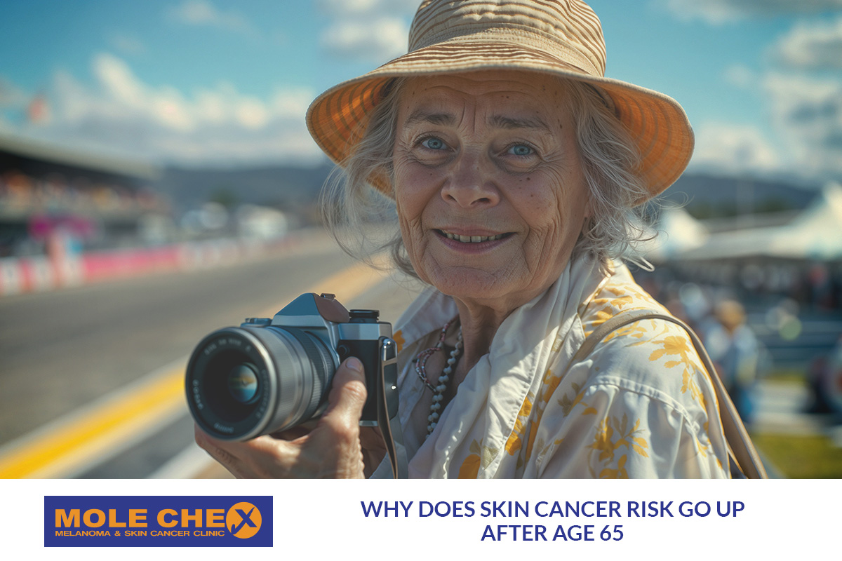 Why Does Skin Cancer Risk Go Up After Age 65?