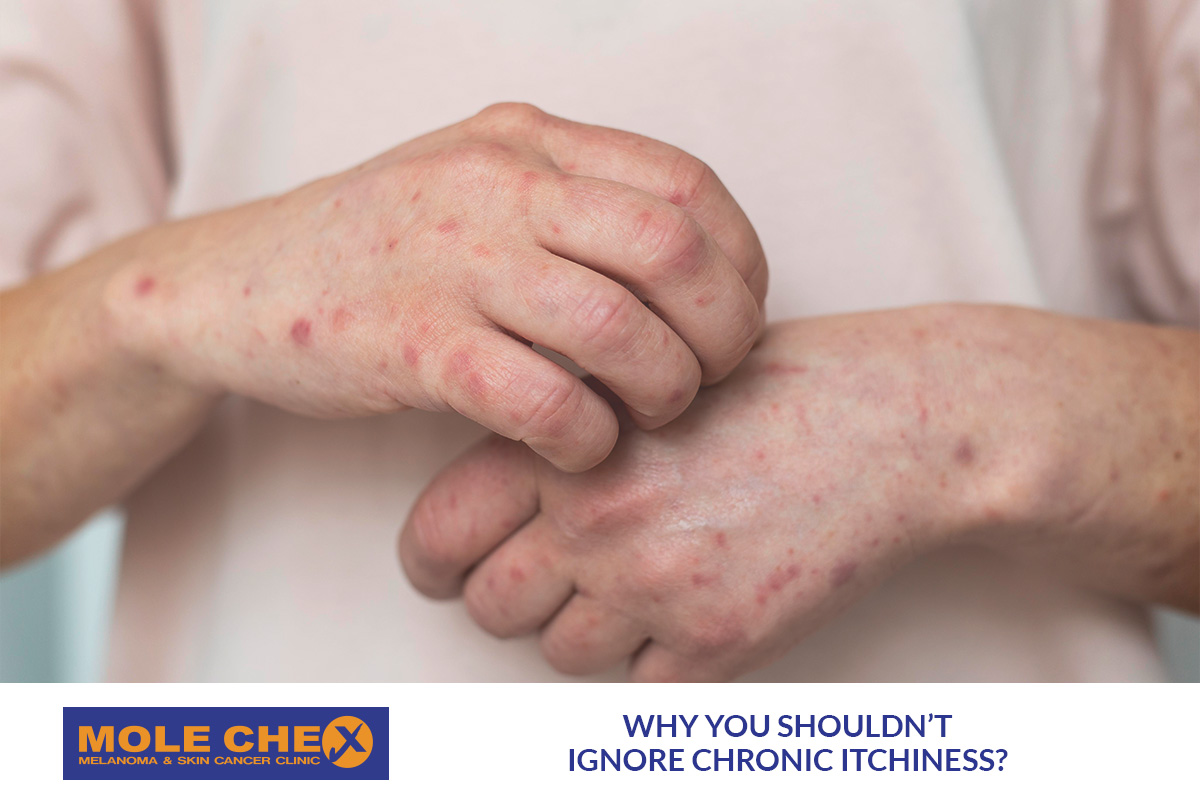Why You Shouldn’t Ignore Chronic Itchiness: When Itchy Skin Needs a Closer Look in Brisbane?