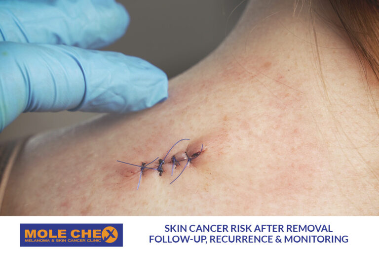 Skin Cancer Risk After Removal: Follow-Up, Recurrence and Ongoing Skin Checks in Brisbane