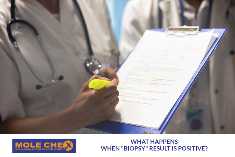 What happens when "Biopsy" result is positive?
