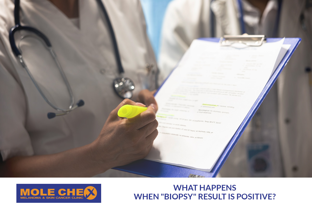 What happens when "Biopsy" result is positive?