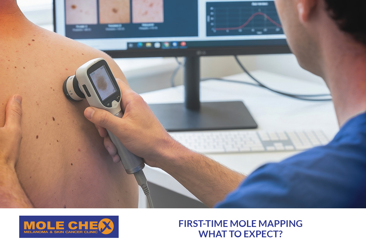 First-Time Mole Mapping in Brisbane: What to Expect