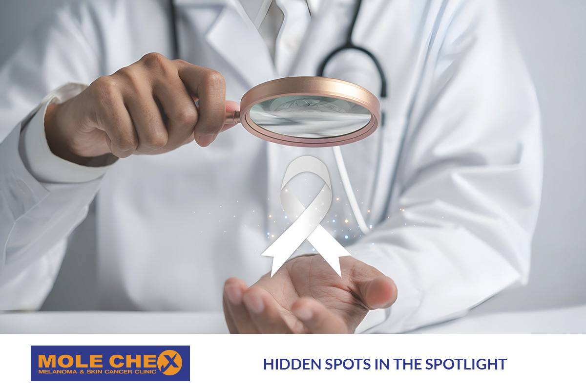 Hidden Spots in the Spotlight: A Skin Check in Brisbane