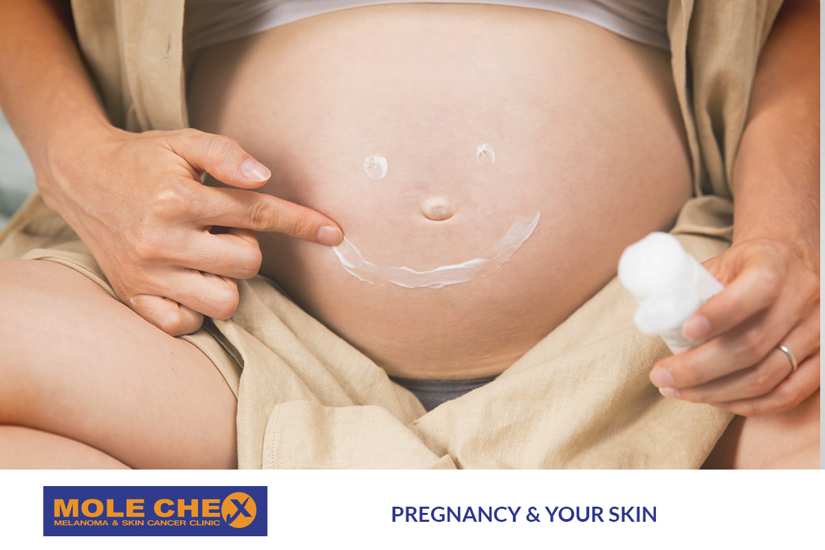 Pregnancy and Your Skin: Distinguishing Hormonal Melasma from Concerning Moles