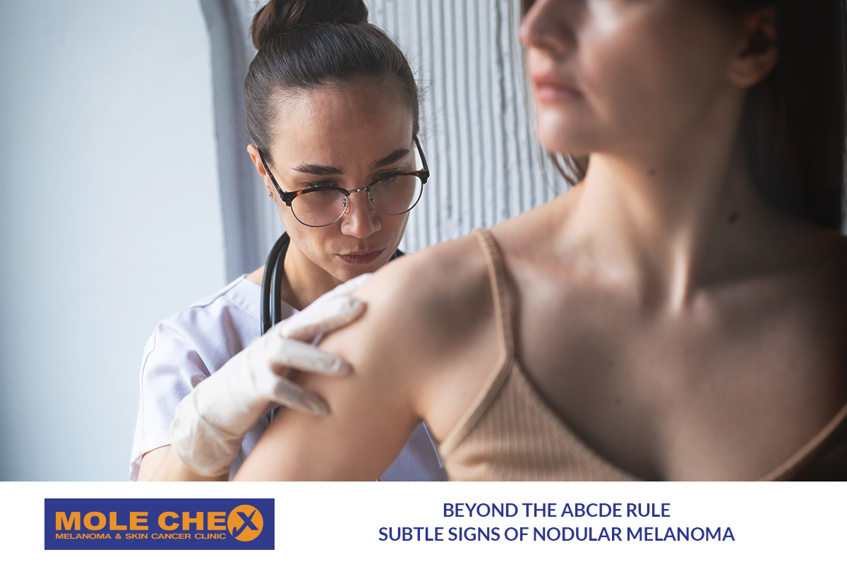 Beyond the ABCDE Rule: Subtle Signs of Nodular Melanoma Brisbane Residents Should Know