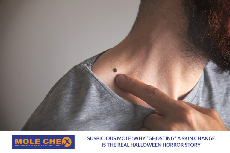 Suspicious Mole: Why “Ghosting” a Skin Change Is the Real Halloween Horror Story